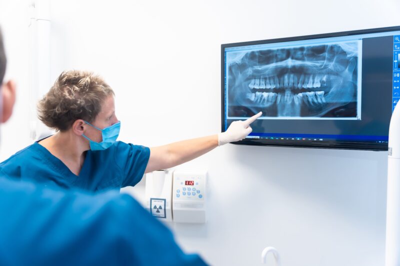 Implant dentar