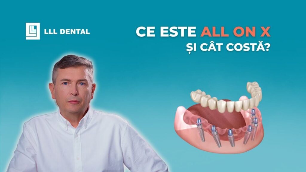 Vezi ce presupune conceptul All-on-X la Clinica LLL Dental