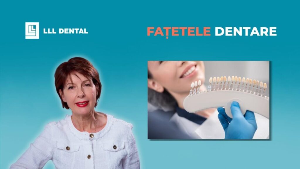 Vezi ce tipuri de fațete dentare folosim la Clinica LLL Dental