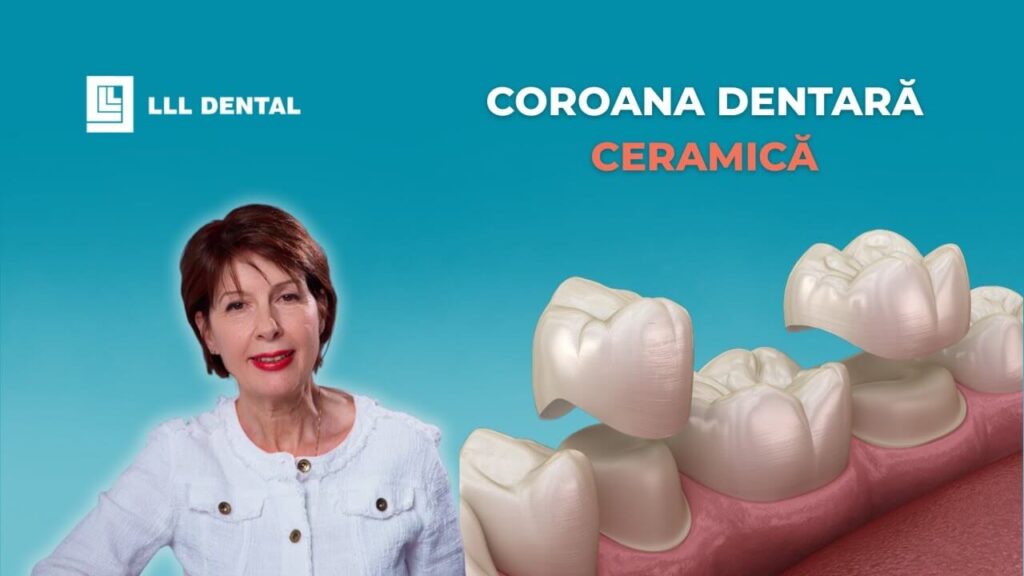Vezi avantajele coroanelor integral ceramice și când le folosim la Clinica LLL Dental