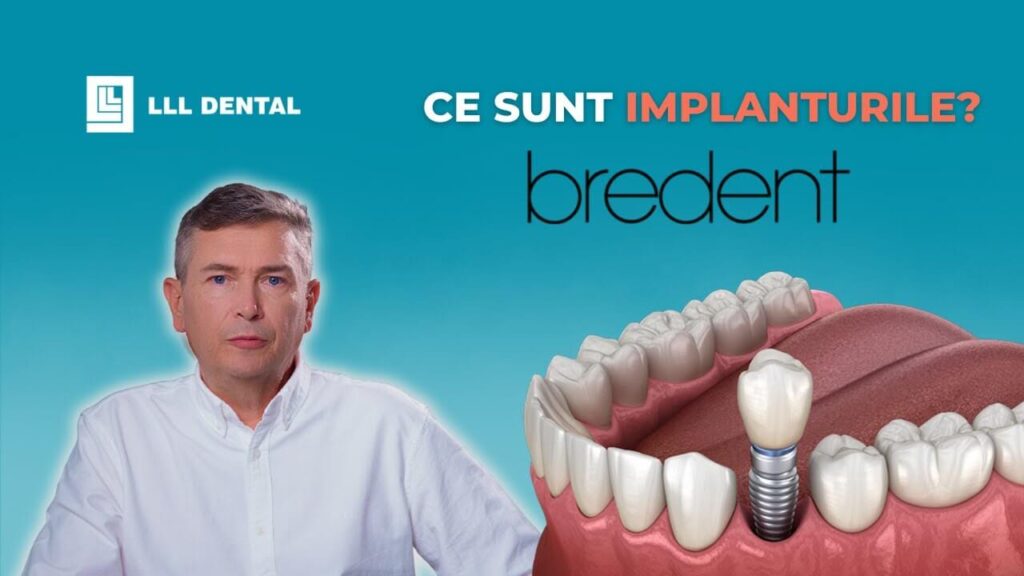 Vezi când recomandăm implanturile Bredent la Clinica LLL Dental