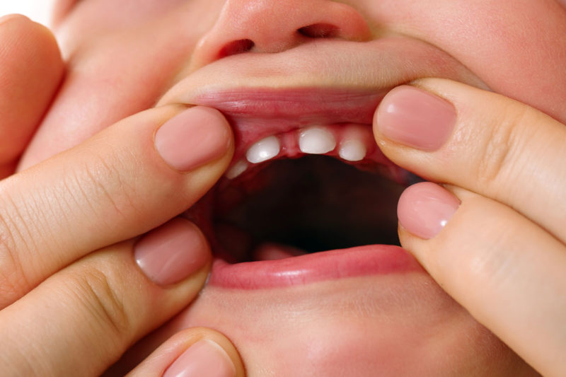 mainile mamei care arata gingiile imflamate ale bebelusului