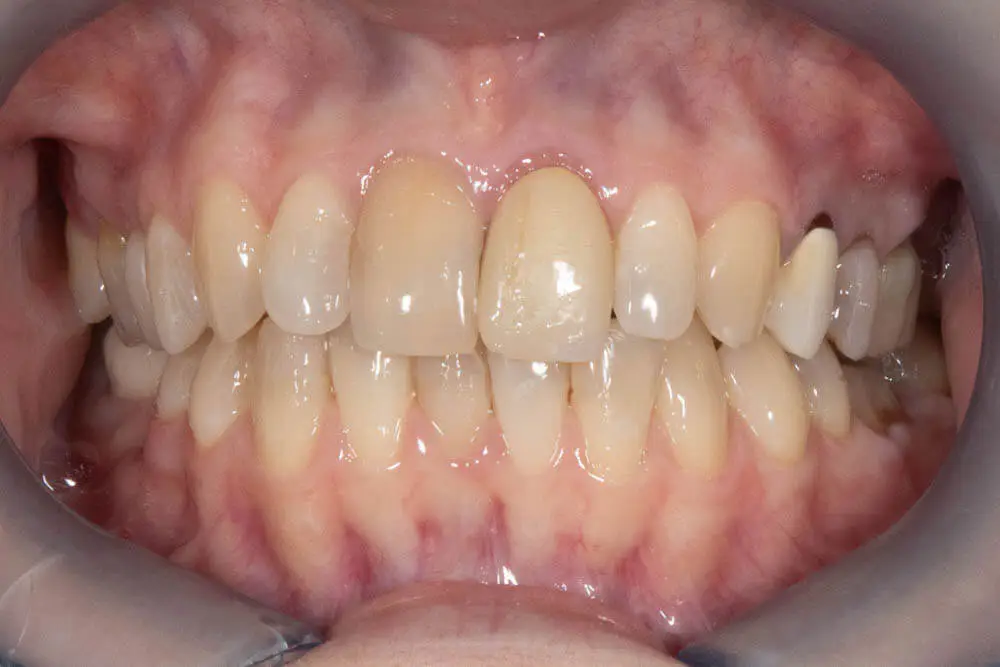 FATETE HOLYWOOD AFTER