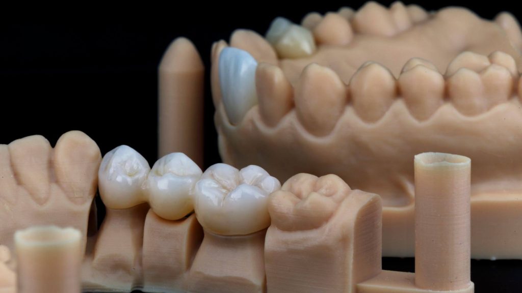 coroane dentare integral ceramica