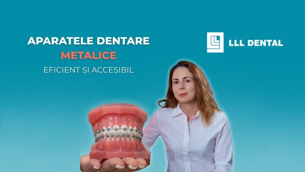 Vezi când recomandăm aparatul dentar metalic la Clinica LLL Dental