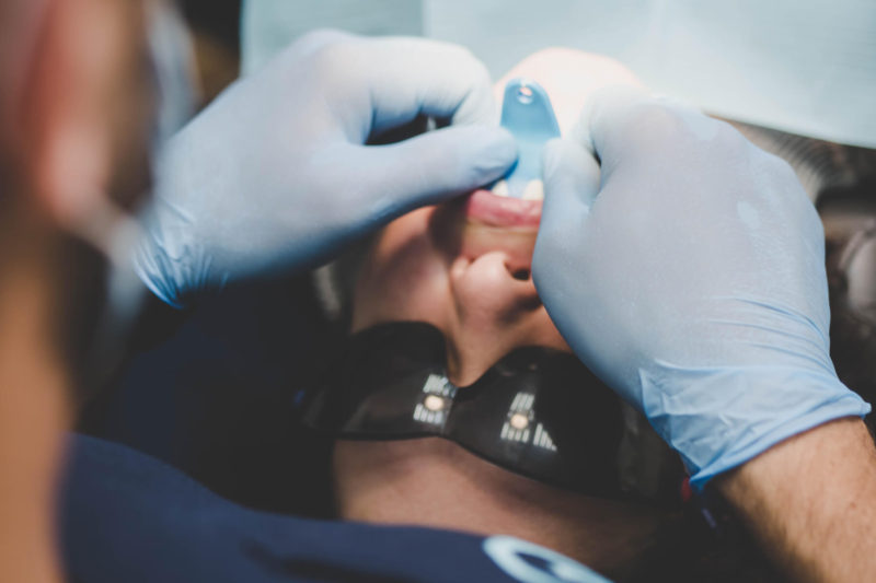 dentist lucrand cu freza dentara