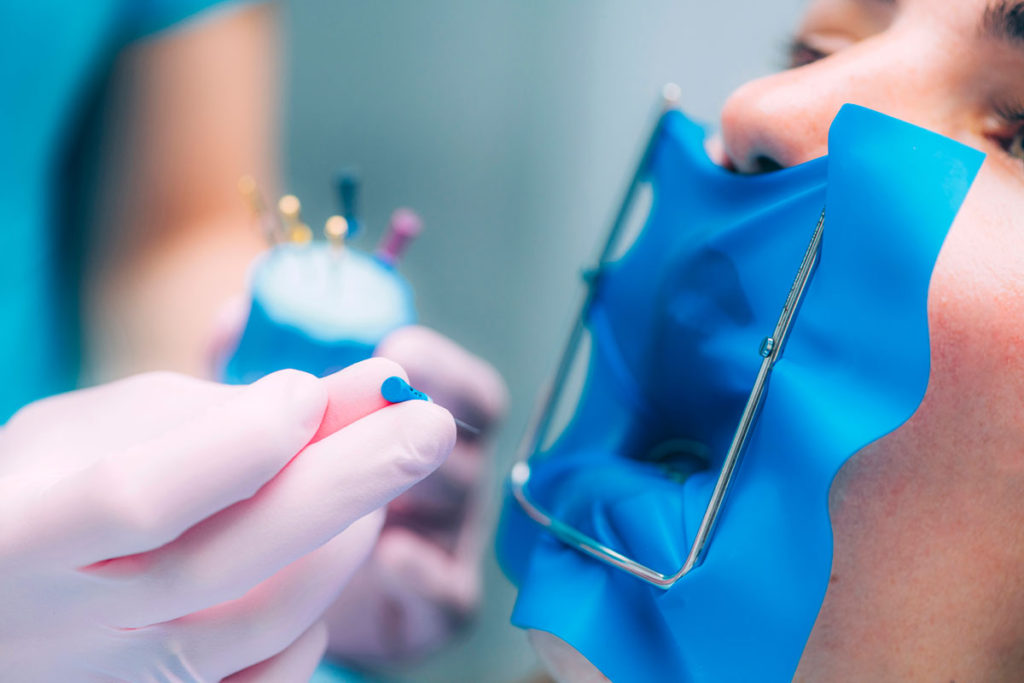 avantajele utilizarii digii dentare