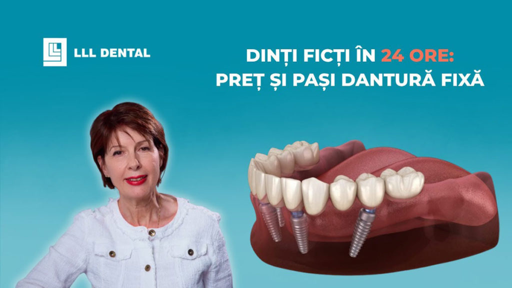Vezi cum facem procedura de dinți ficși la clinica LLL