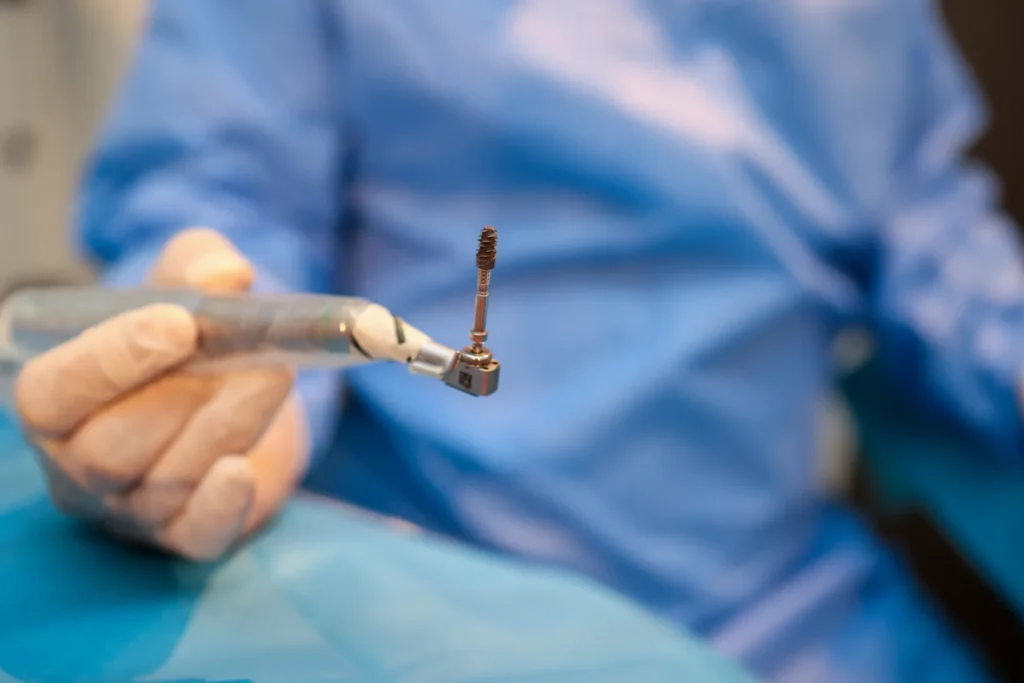 pretul unui implant dentar