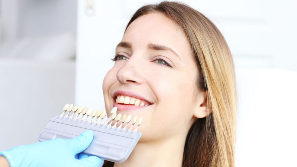 rolul fatetelor dentare provizorii