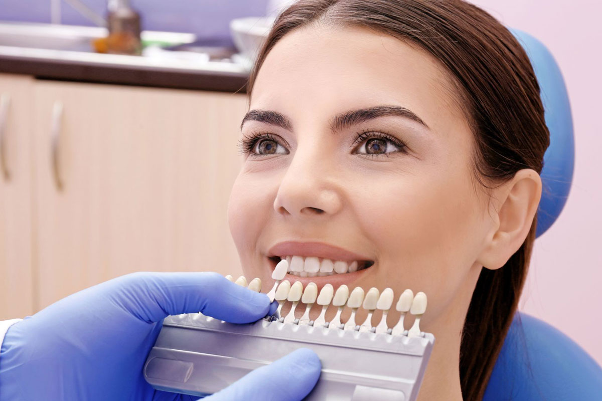 Care este media de viață a fațetelor dentare Emax?
