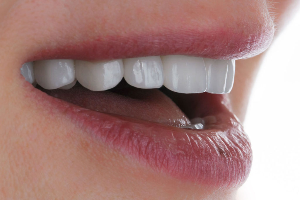 fatete dentare zirconiu