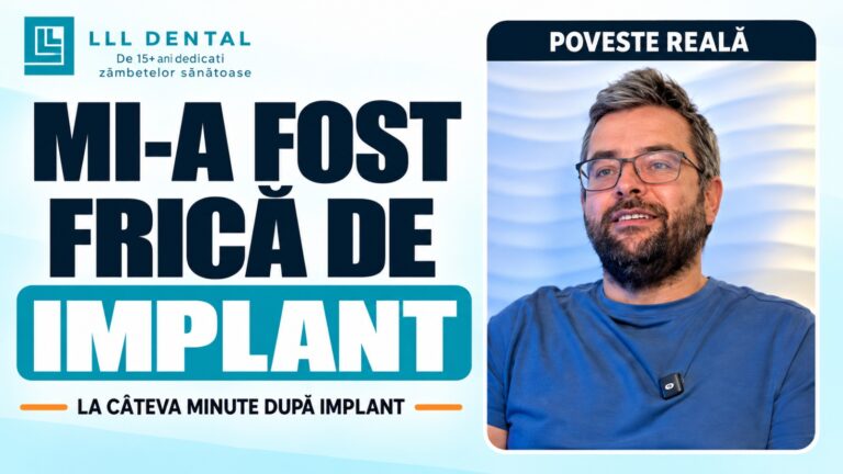 frica de implant dentar