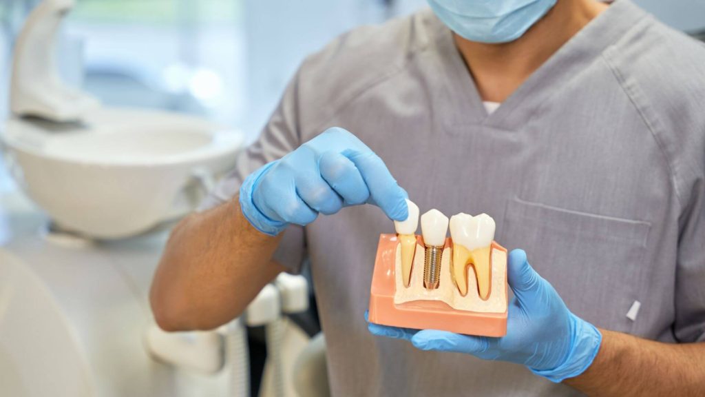 implant dentar zirconiu