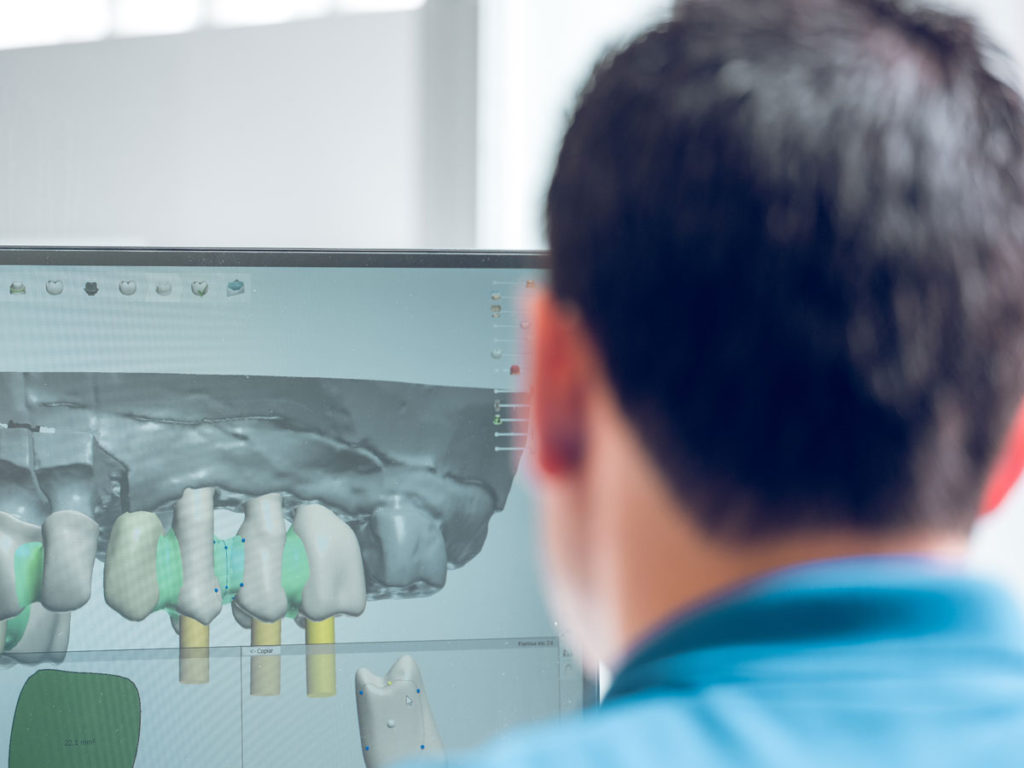 medic dentist analizeaza pe computer  implantul dentar