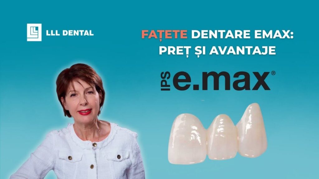 Vezi de ce recomandăm fațetele Emax la Clinica LLL Dental