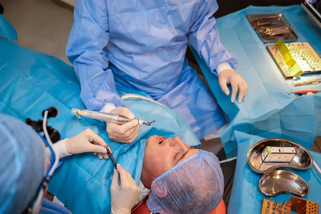 alegerea tipului de implant dentar