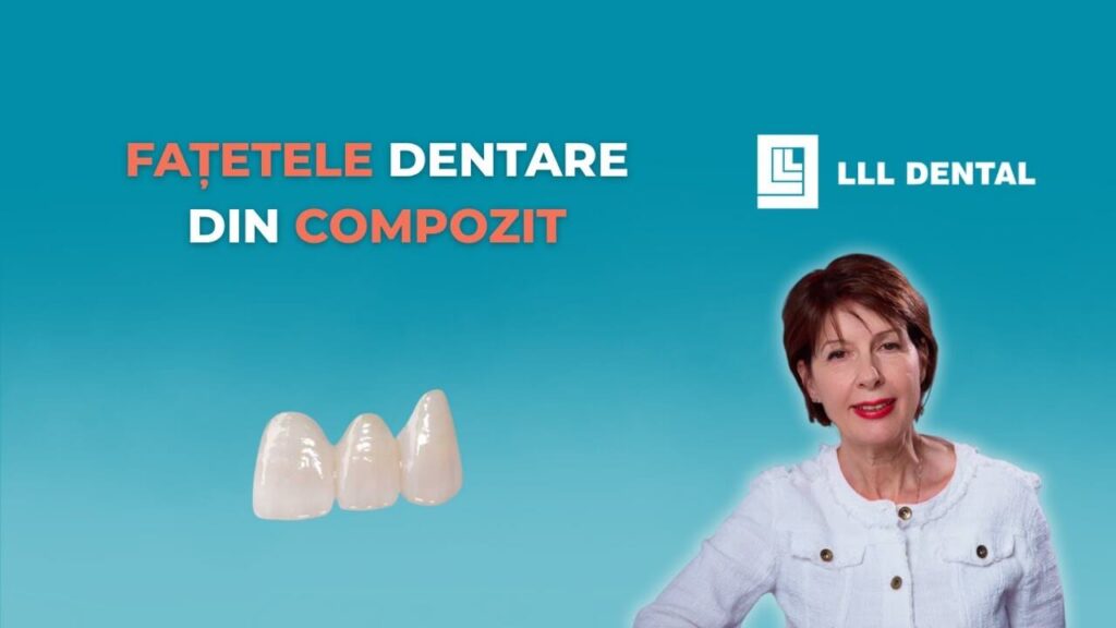 Vezi când considerăm potrivite fațetele din compozit la Clinica LLL Dental