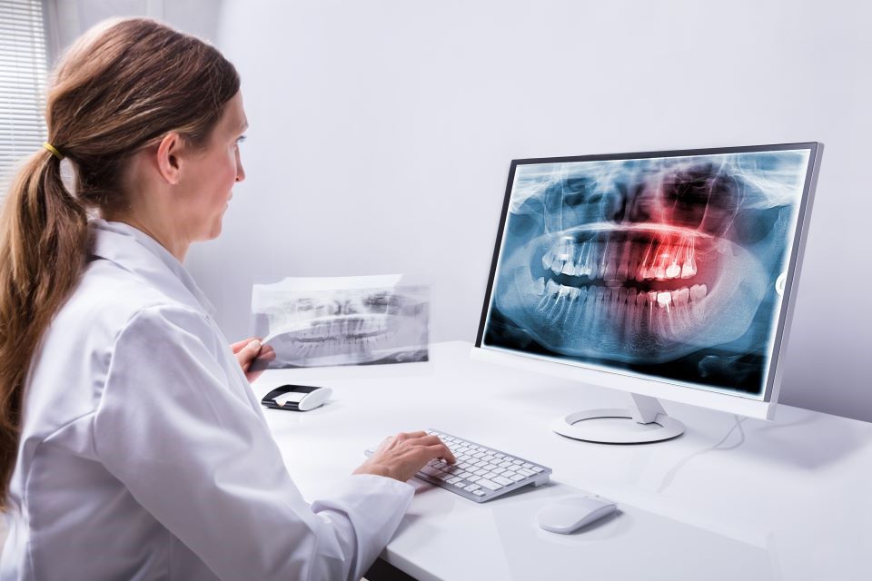Avantajele sistemului folosit de LLL Dental