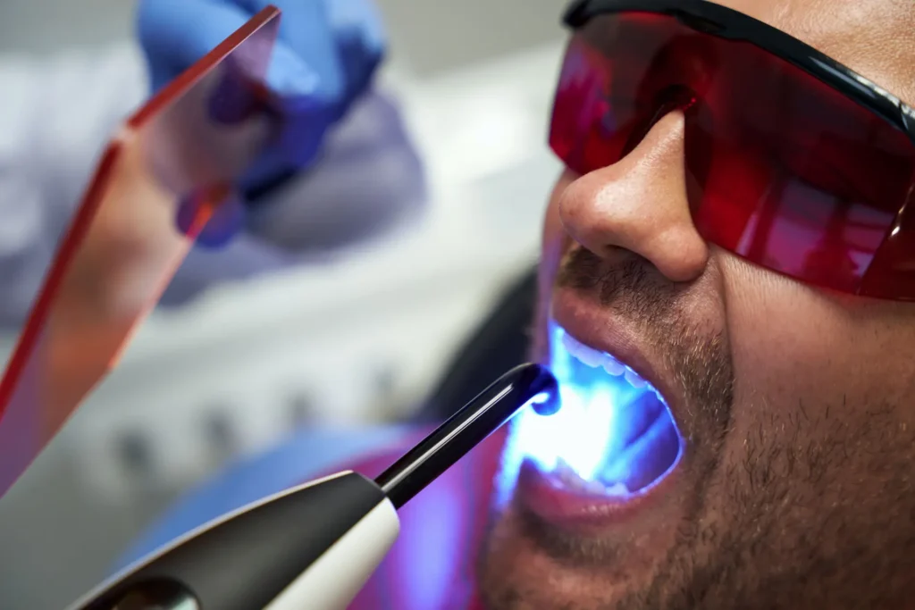 tratament parodontoza laser