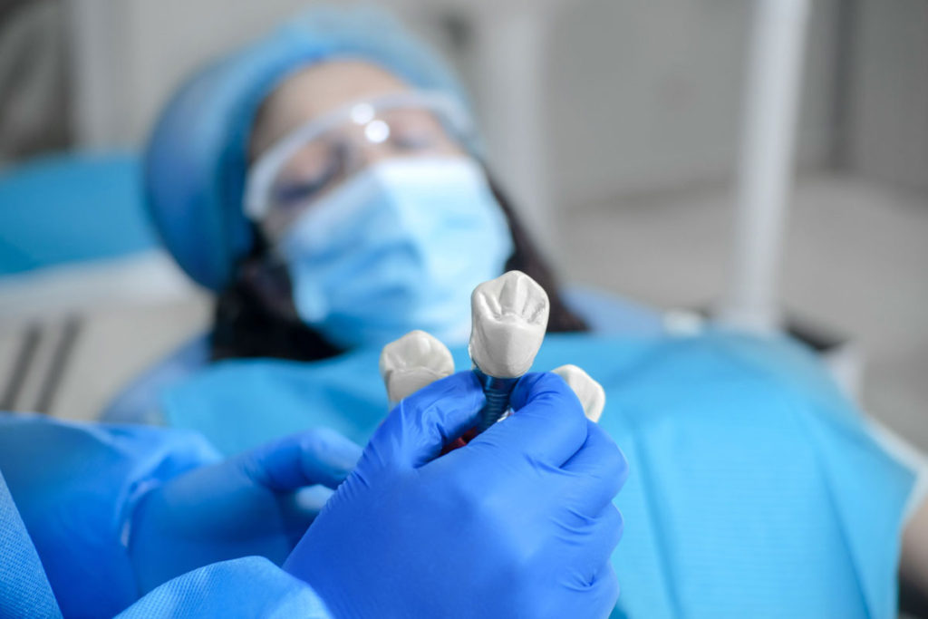 prim-plan cu model de implant