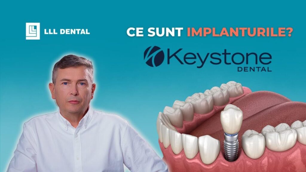 Vezi când recomandăm implanturile Keystone la Clinica LLL Dental