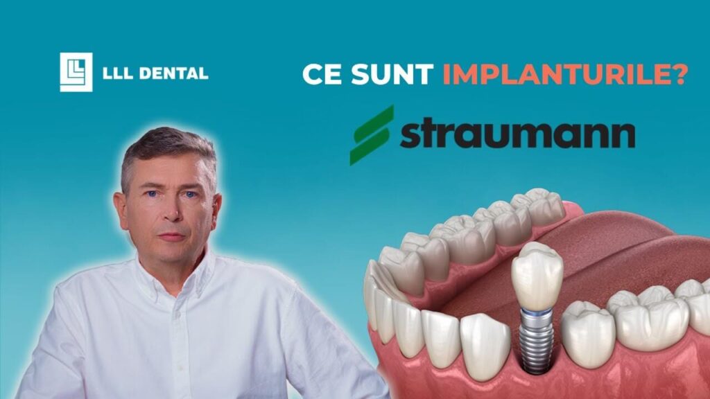 Vezi când recomandăm implanturile Straumann la Clinica LLL
