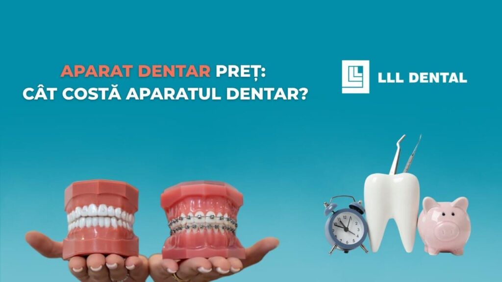 Vezi cum se stabilește costul tratamentului ortodontic la Clinica LLL Dental